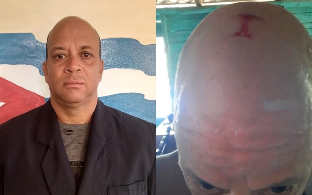 Cuba | Golpean y amenazan a periodista independiente José Antonio López Piña en Santiago de Cuba